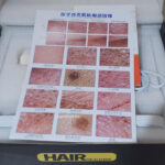 دستگاه آنالیز پوست و مو 11 اینچ لیز - تصویر 7